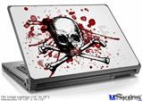 Laptop Skin (Large) - Bleed so Pretty